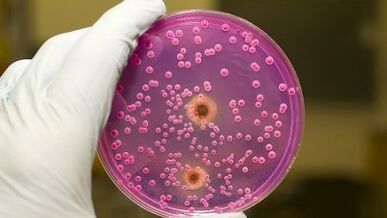 Pathological discharge in men when he is excited